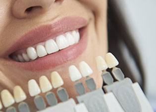 Young woman with natural-looking porcelain veneers