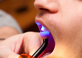 dental light