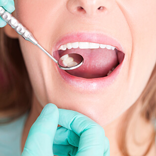 Woman being examined with dental mirror