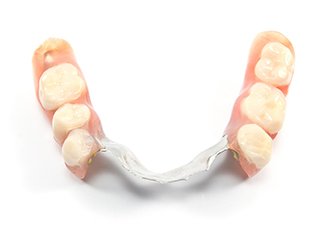 partial denture