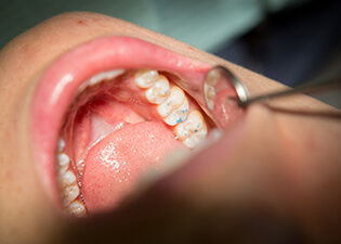 Dentist assessing smile after completing treatment