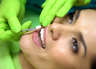 cosmetic dentist in Marlton placing a veneer on a patient’s tooth 
