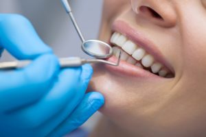 Woman having a dental cleaning
